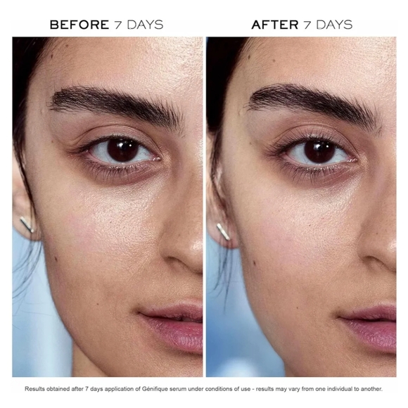 Lancôme Advanced Génifique Youth Activating Serum - Picture 5 of 8